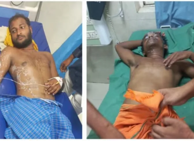 स्मैक पीने से मना करने पर तेज़ाबी हमला: अररिया में दर्जनों घायल।